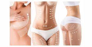 Tummy Tuck Recovery: Tips from Miami’s Experts